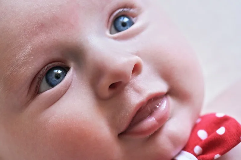 Tamiz visual neonatal